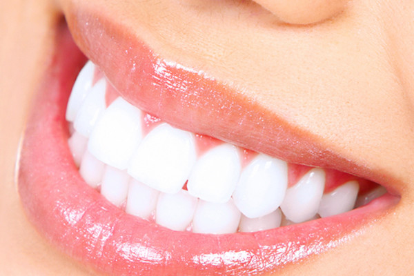 come-avere-denti-bianchi